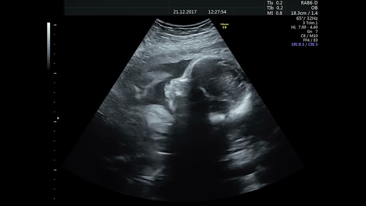 The very first picture of you, from the twenty-week scan. Keeping us all waiting even then.